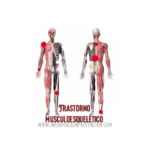 Transtornos musculoesqueléticos (TME)